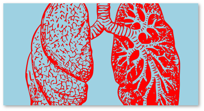 lung-cancer-marijuana