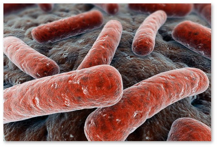 Mycobacterium tuberculosis