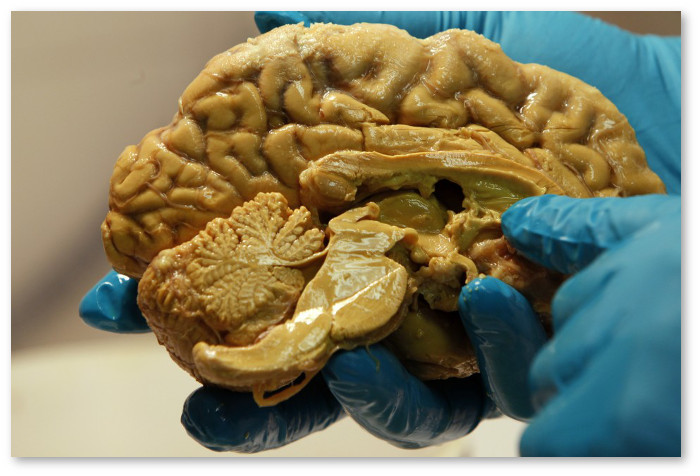brain-human