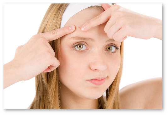 Natural-acne-scar-removal-tips