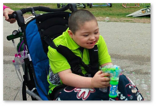 ребенок с синдромом Драве