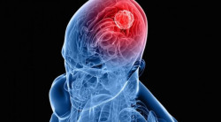 rol-kbd-v-lechenii-raka