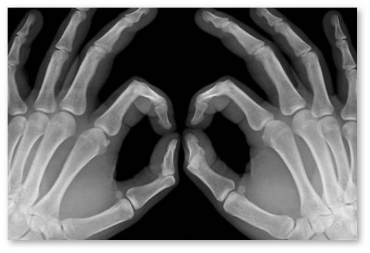 konoplya-posle-perelomov