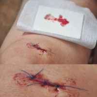 rol-konopli-v-zazhivlenii-ran