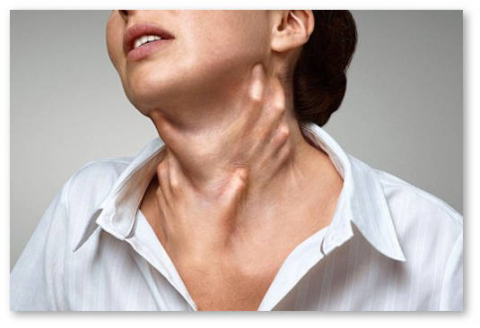 otek-kvinke-i-konoplya