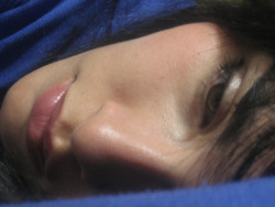 sindrom-hronicheskoj-ustalosti