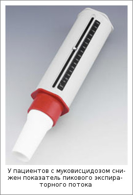 У пациентов с муковисцидозом снижен показатель пикового экспираторного потока