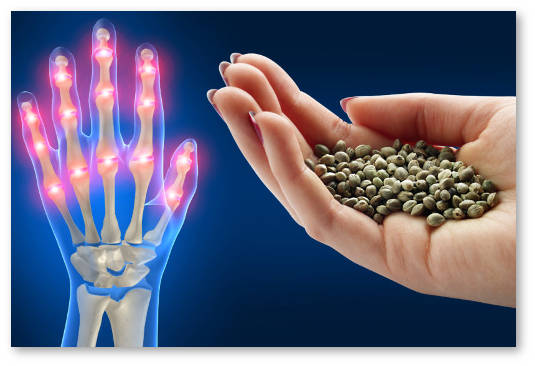 semena konopli dlya lecheniya osteoartrita