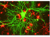 Болезнь Альцгеймера вызывается дефицитом эндоканнабиноидов