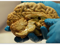 Возможная роль веществ конопли в защите мозга от воспаления