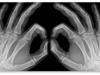 Исследование: Роль веществ конопли в заживлении костей