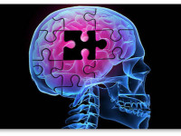 Исследование: Масло каннабиса помогает в облегчении симптомов болезни Альцгеймера